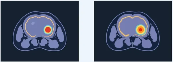 Imaging visualizations